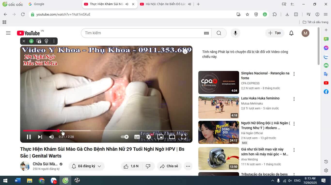 VÔ COI CHỮA SÙI MÀU GÀ NÈ
