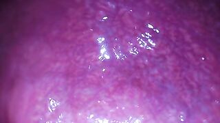 nhét camera vô lỗ đít rồi thủ dâm bằng sex toy bên trong lỗ đít của tôi