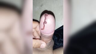 Thả giun chui vào cu