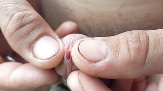 Thả giun vào cu 2