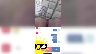 ometv gặp bé gái không lông
