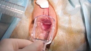 [Độc Lạ] - Cận cảnh màn khám lồn cho em gái bị sùi