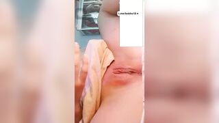 Rau Việt lồn hồng múp không lông P3