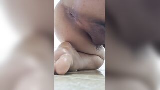 Vệ sinh lỗ ass