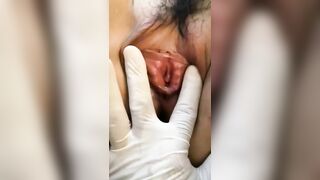 Lồn dâm găm bi