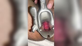 Bên trong lổ đít của tôi p2