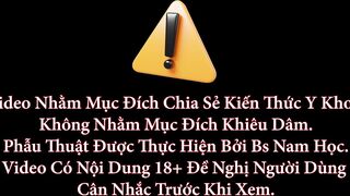 Khám sùi mào gà