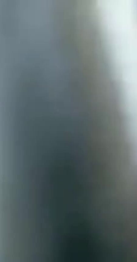Em gái ngứa tayy