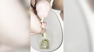 thông lổ đái phần 1