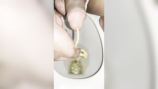 thông lổ đái phần 1
