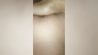 Móc lồn ko lông
