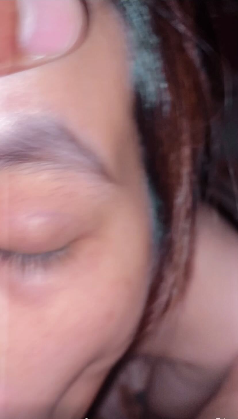 Lồn múp 5