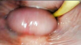 Góc nhìn nội soi âm đạo khi làm tình, cuối cùng xuất tinh trong và kết thúc hạnh phúc