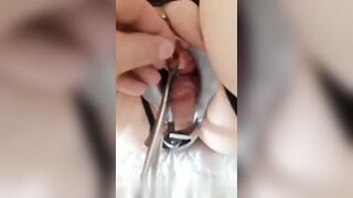 Video hiếm, cái này là vòng xỏ lỗ niệu đạo, quá quái dị nặng đô.