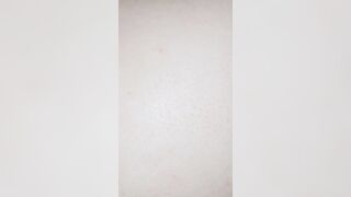Khám bướm em gái Hải Phòng