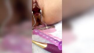 em loli thông niệu đạo  6
