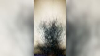 bé 2k7 má lông rậm quá em à