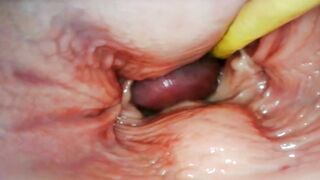 AMAZING INTERNAL POV. CAMERA INSIDE HER PUSSY WHILE I FILL HER WITH CUM