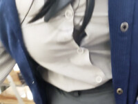 Thương cái cúc áo